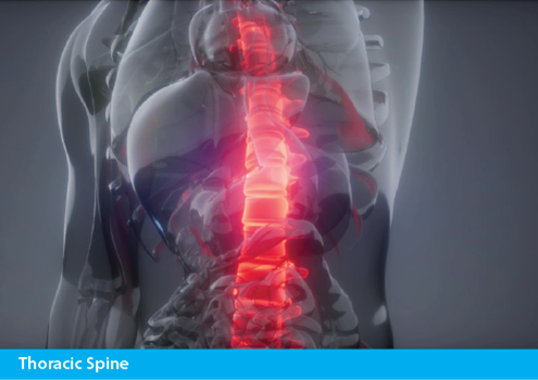 Achillies Clinic Thoracic Spine Treatments